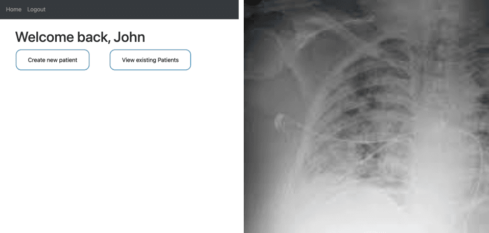 Covid-19 Diagnosis Website 